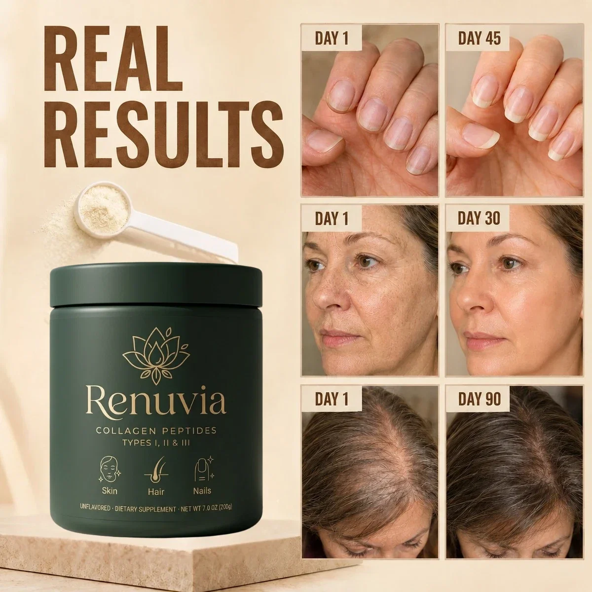 Renuvia — real results, before and after